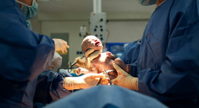 Baby,Being,Born,Via,Caesarean,Section,Coming,Out