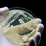 Gloved hand holding petri dish with bacterial colonies