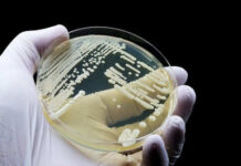 Gloved hand holding petri dish with bacterial colonies