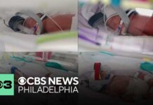 One Surprise Became Four Incredible Blessings Rare identical quadruplets born in Australia