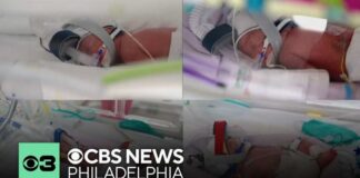 Rare identical quadruplets born in Australia