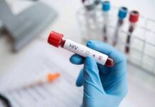 Gloved hand holding a blood sample tube labeled for HIV test